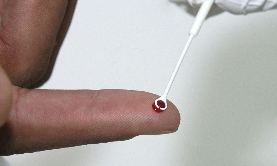 Vírus da AIDS está resistindo a remédio no Brasil. Pesquisadores pedem genotipagem prévia Vírus da AIDS está resistindo a remédio no Brasil. Pesquisadores pedem genotipagem prévia