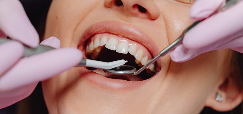 opened mouth woman during dental treatment